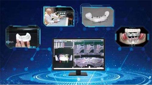 口腔種植手術(shù)導(dǎo)航定位系統(tǒng)同品種臨床評價(jià)注冊審查指導(dǎo)原則(2021年第93號(hào))(圖1) 口腔種植手術(shù)導(dǎo)航定位系統(tǒng)同品種臨床評價(jià)注冊審查指導(dǎo)原則(2021年第93號(hào))(圖1)