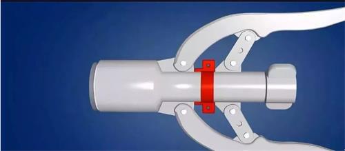 包皮切割吻合器注冊(cè)審查指導(dǎo)原則(2021年第102號(hào))(圖1) 包皮切割吻合器注冊(cè)審查指導(dǎo)原則(2021年第102號(hào))(圖1)