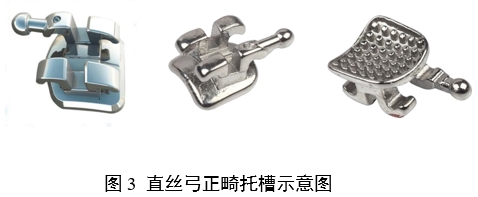 正畸托槽注冊(cè)審查指導(dǎo)原則(2022年第41號(hào))(圖3) 正畸托槽注冊(cè)審查指導(dǎo)原則(2022年第41號(hào))(圖3)