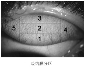 接觸鏡護理產(chǎn)品注冊審查指導原則(2023年修訂版)(2023年第9號)(圖7) 接觸鏡護理產(chǎn)品注冊審查指導原則(2023年修訂版)(2023年第9號)(圖7)