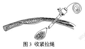 一次性使用內(nèi)窺鏡用活檢袋注冊(cè)審查指導(dǎo)原則(2025年第20號(hào))(圖3) 一次性使用內(nèi)窺鏡用活檢袋注冊(cè)審查指導(dǎo)原則(2025年第20號(hào))(圖3)