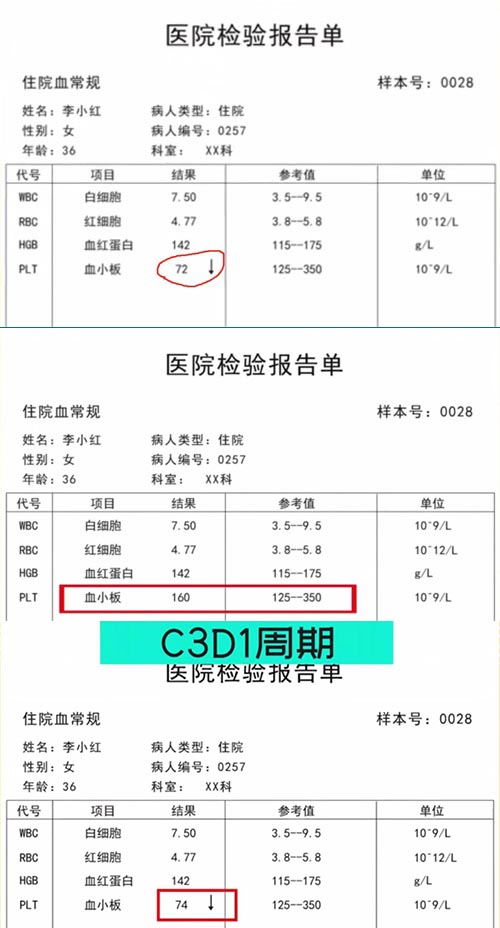 AE與研究藥物關(guān)系記錄不一致，如何處理？