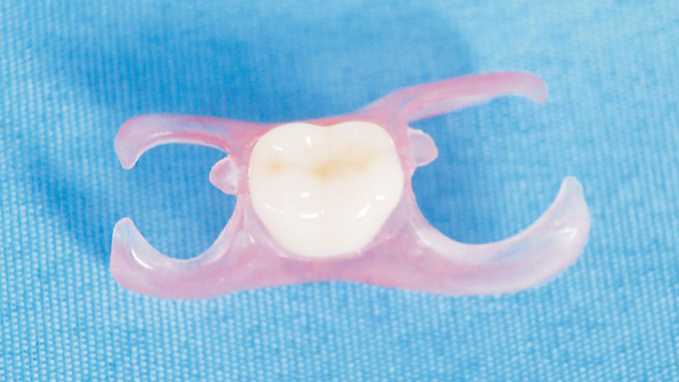 定制式義齒注冊技術(shù)審查指導(dǎo)原則(2018年修訂)(2018年第80號)(圖1) 定制式義齒注冊技術(shù)審查指導(dǎo)原則(2018年修訂)(2018年第80號)(圖1)